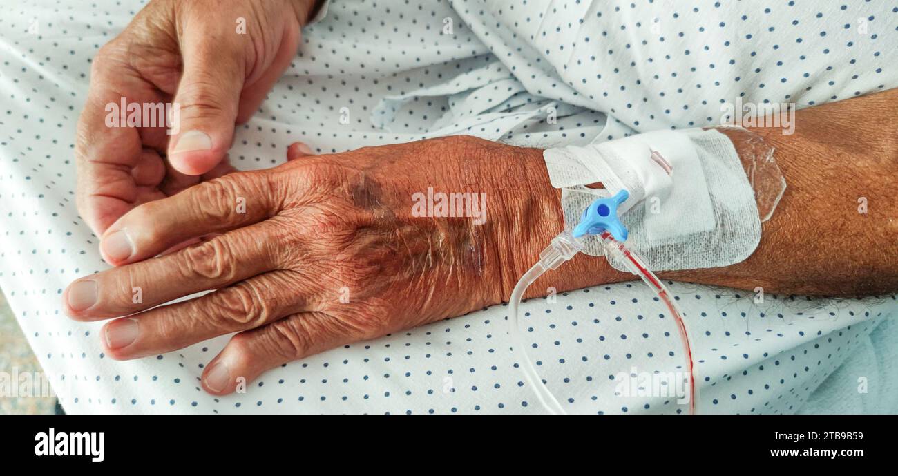 Ältere Hände mit Arthrose und Venenkatheter Stockfoto