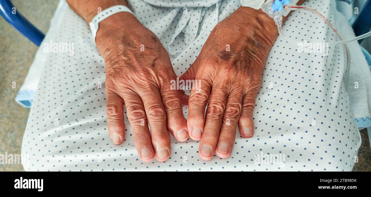 Ältere Hände mit Arthrose und Venenkatheter Stockfoto