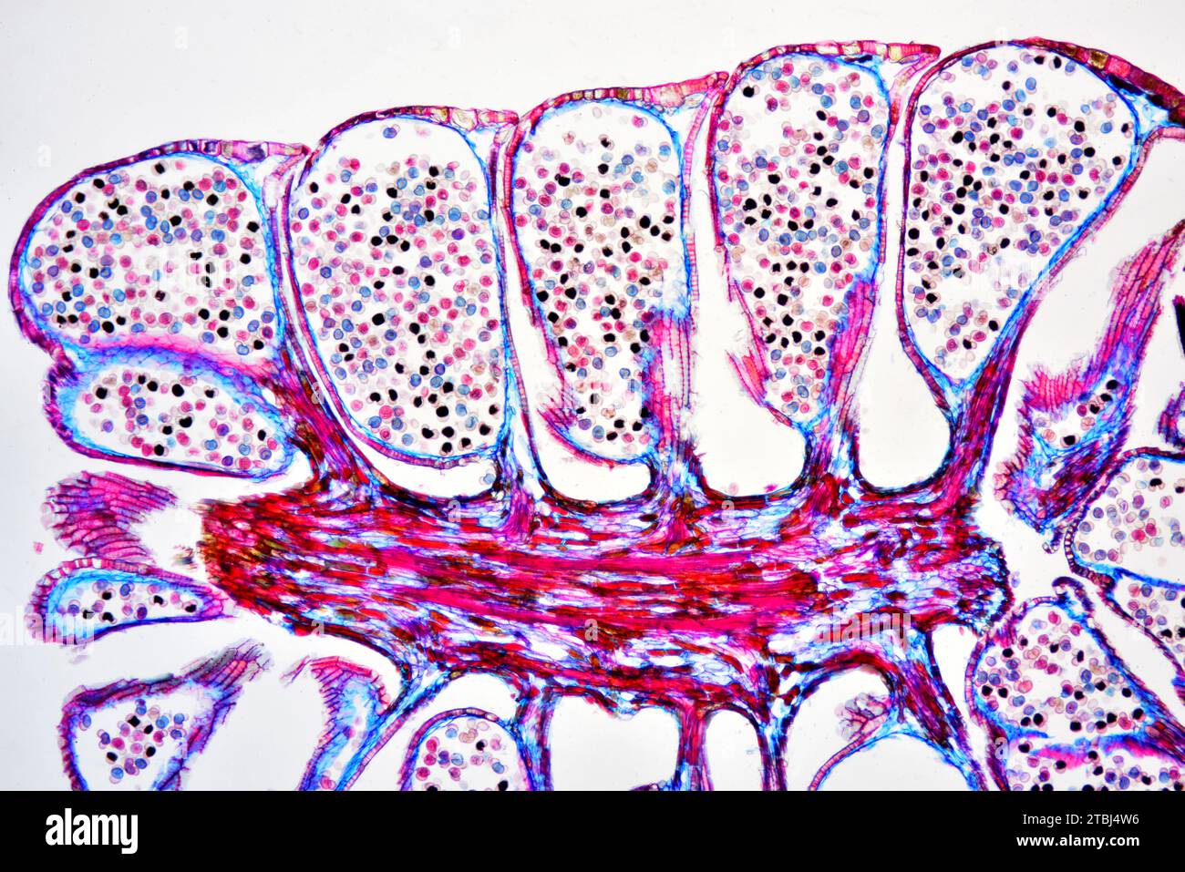 Männlicher Kiefernkegel (Pinus sp.) Zeigt Pollen. Optisches Mikroskop X40. Stockfoto