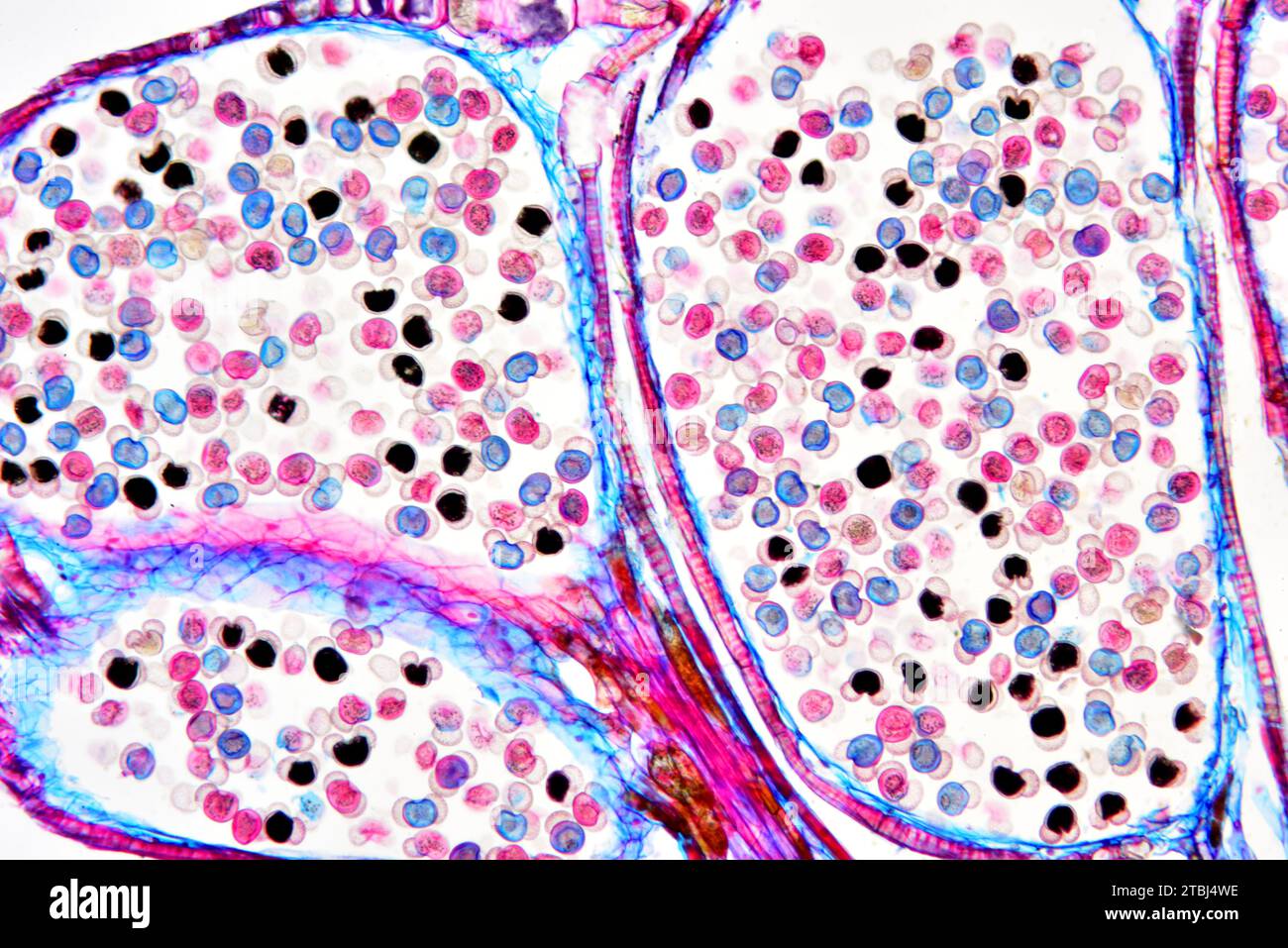 Männlicher Kiefernkegel (Pinus sp.) Zeigt Pollen. Optisches Mikroskop X100. Stockfoto