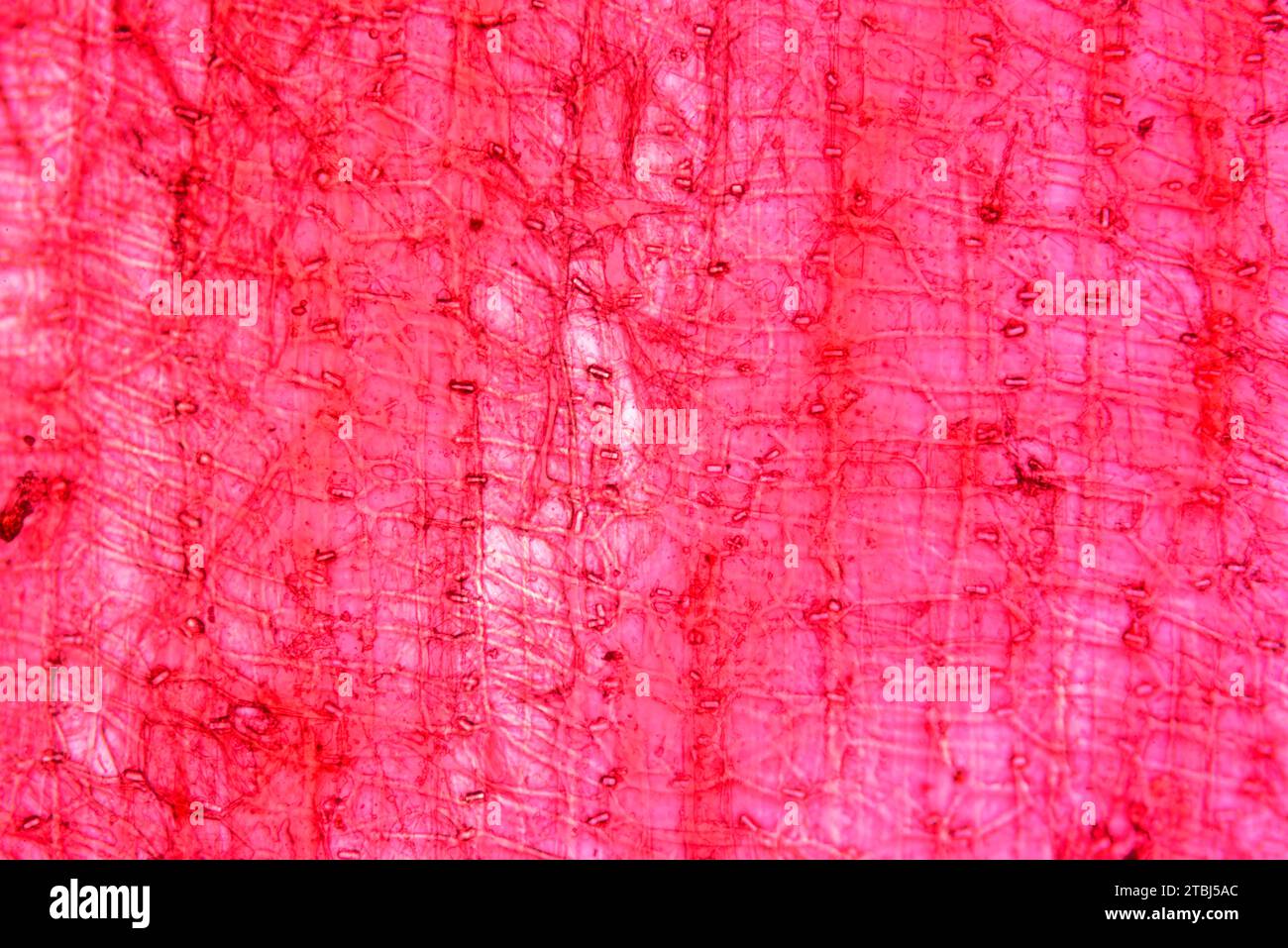 Calciumoxalat-Kristalle in Zwiebeln (Allium cepa). Optisches Mikroskop X100. Stockfoto