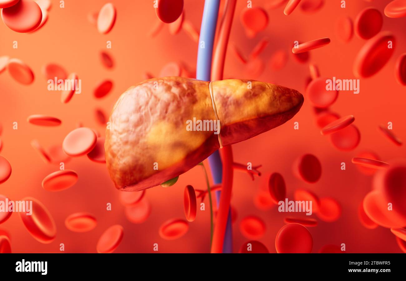 Leberorgan mit Fettleberzustand, 3D-Rendering. 3D-Abbildung. Stockfoto