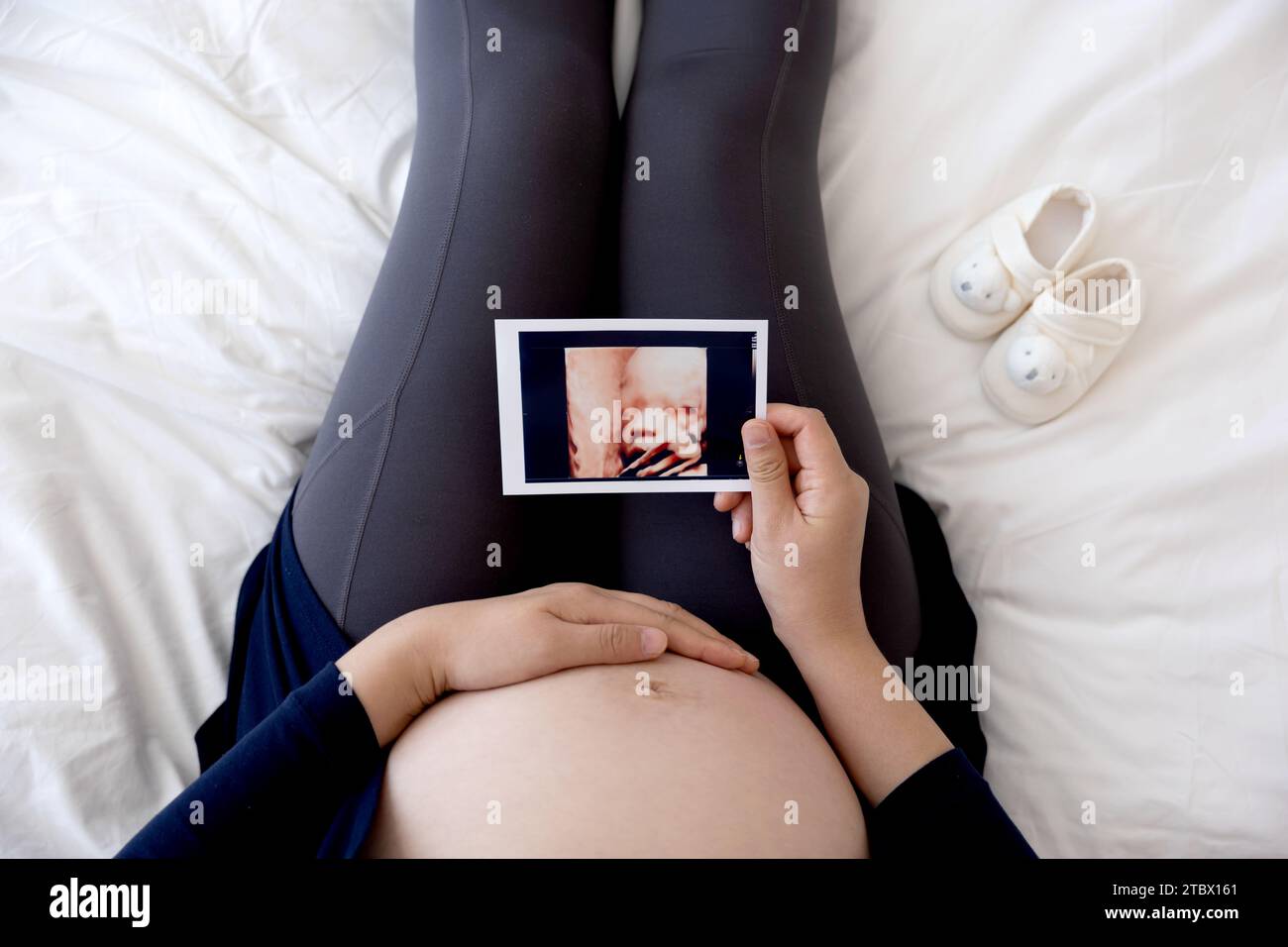 Schwangere Frau, die auf dem Bett sitzt und ein stereoskopisches Ultraschallbild hält Stockfoto