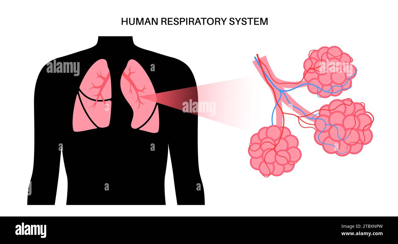 Lungenerkrankungen, Illustration Stockfoto
