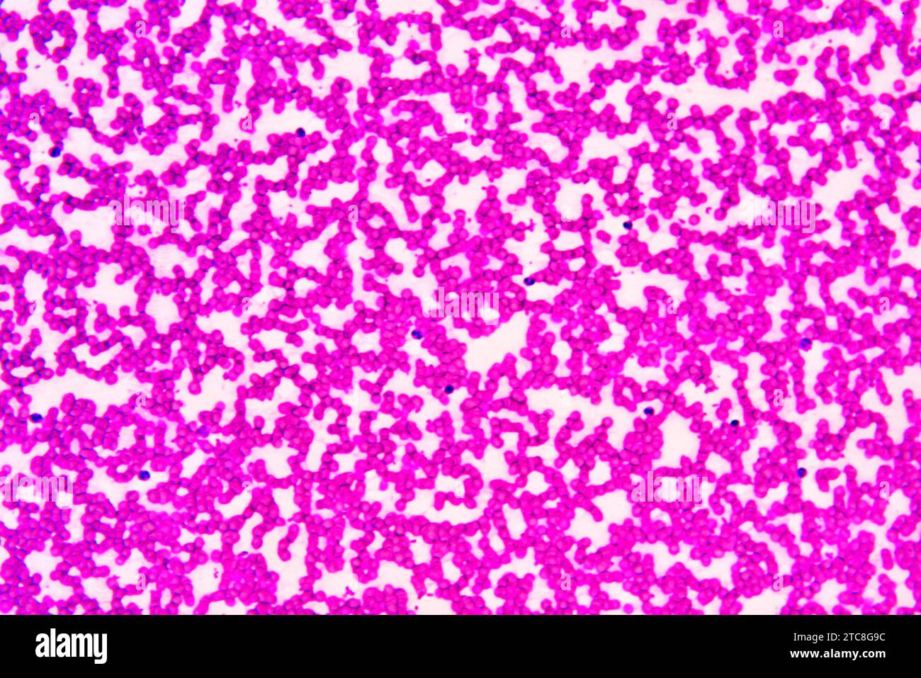 Säugetierblut mit Erythrozyten und Leukozyten. Lichtmikroskop X300 mit einer Breite von 10 cm. Stockfoto