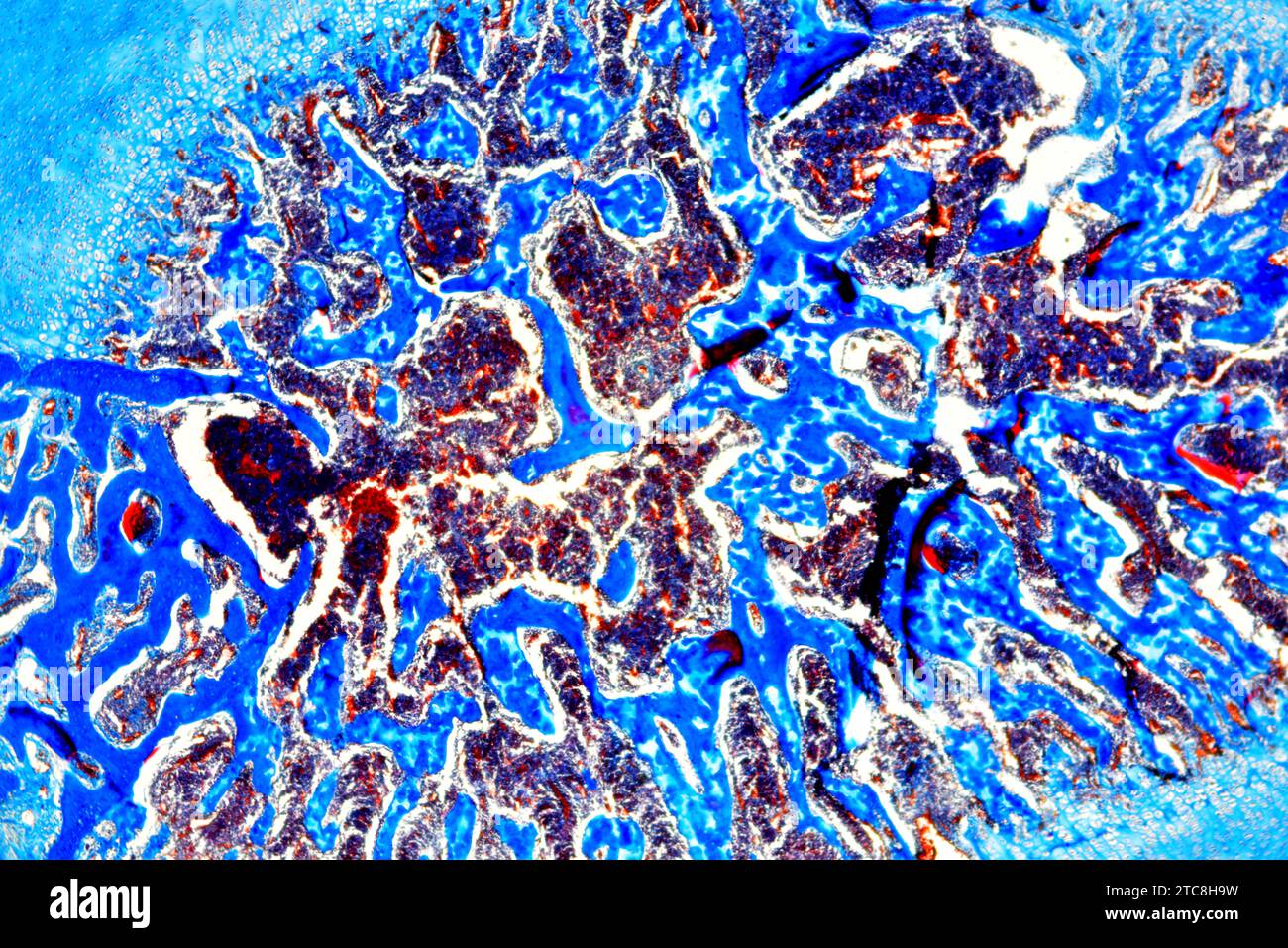 Der kanzeröse oder schwammige Knochen ist ein hämatopoetisches Organ. Lichtmikroskop X40 mit 10 cm Breite. Stockfoto