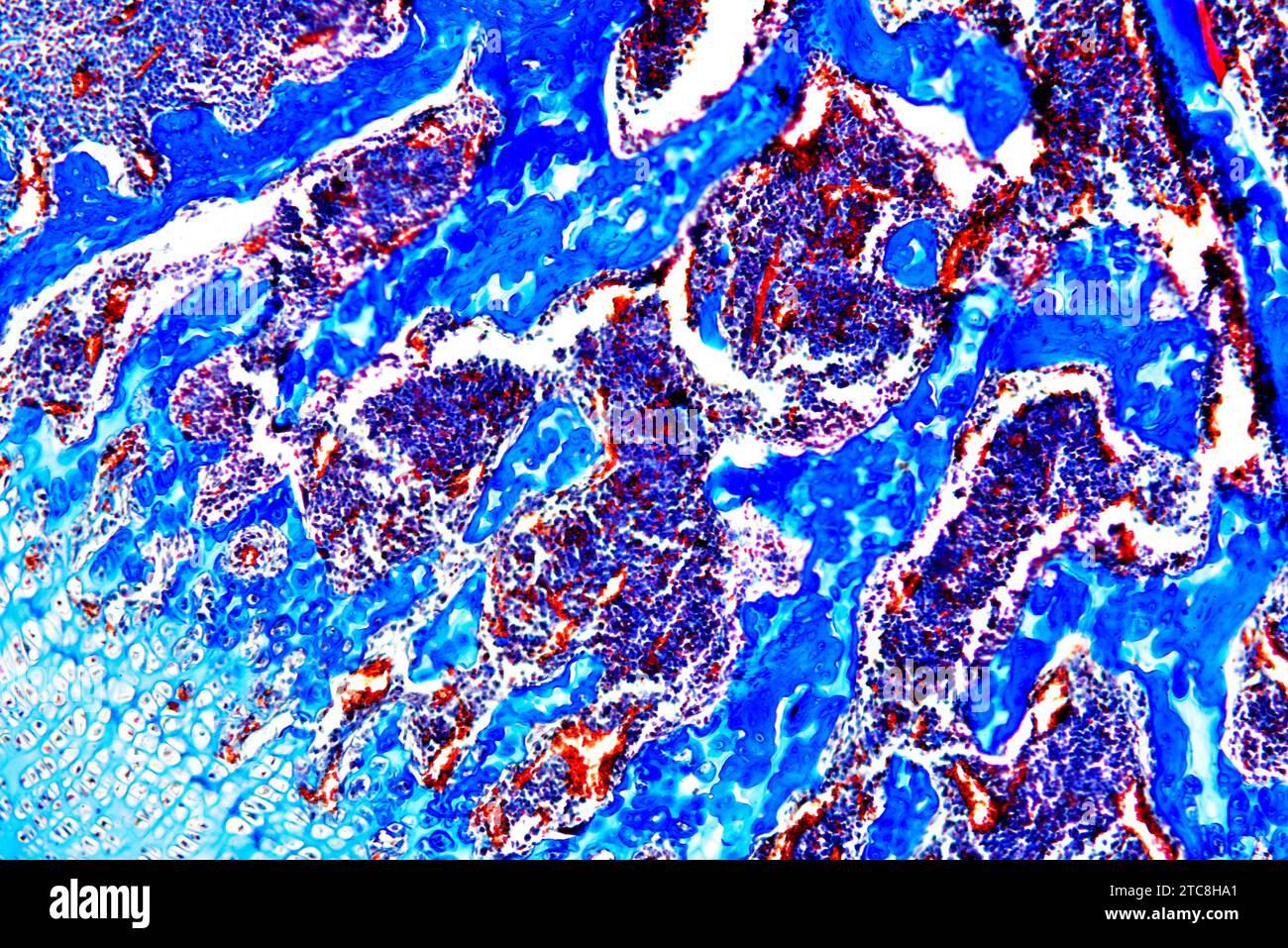 Der kanzeröse oder schwammige Knochen ist ein hämatopoetisches Organ. Lichtmikroskop X150 mit einer Breite von 10 cm. Stockfoto