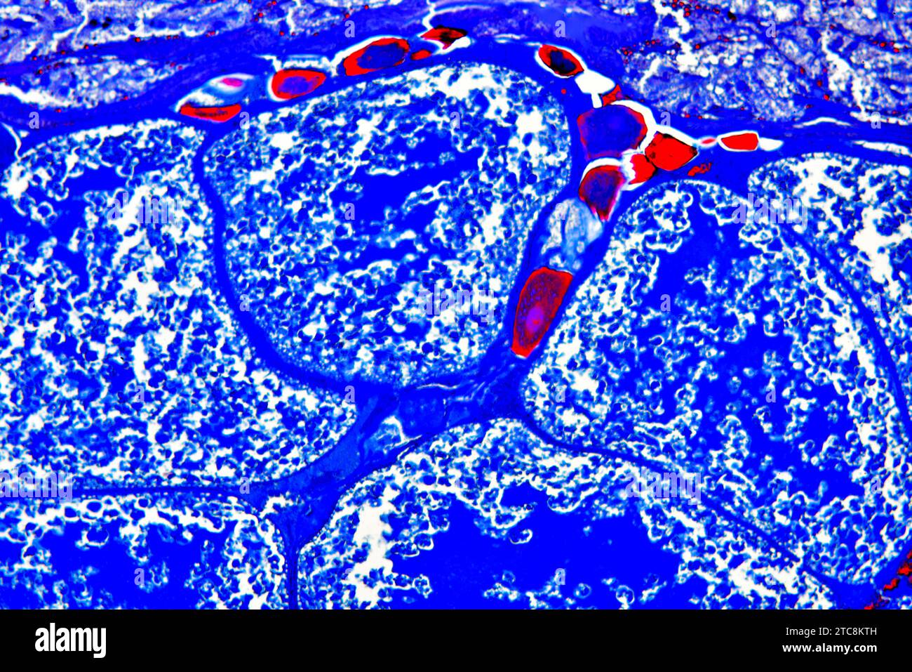 Buchlunge der Gartenspinne (Araneus sp.) Querschnitt. Lichtmikroskop X150 mit einer Breite von 10 cm. Stockfoto
