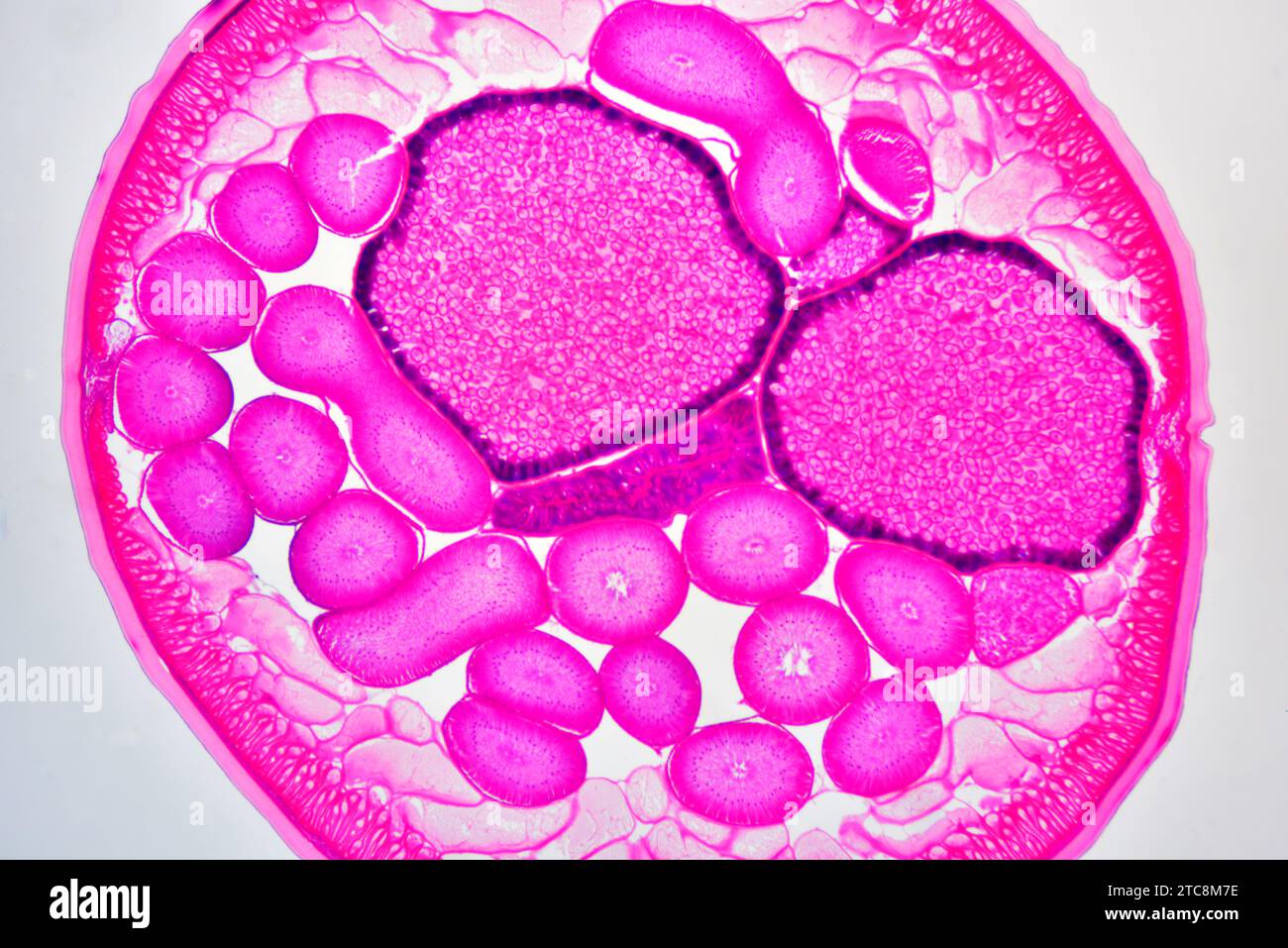 Ascaris lumbricoides weiblich mit Kutikula, Epithel, Längsmuskeln, Pseudocoelom, Eierstöcken, Uterus und Darm. Lichtmikroskop X50 bei 10 Stockfoto