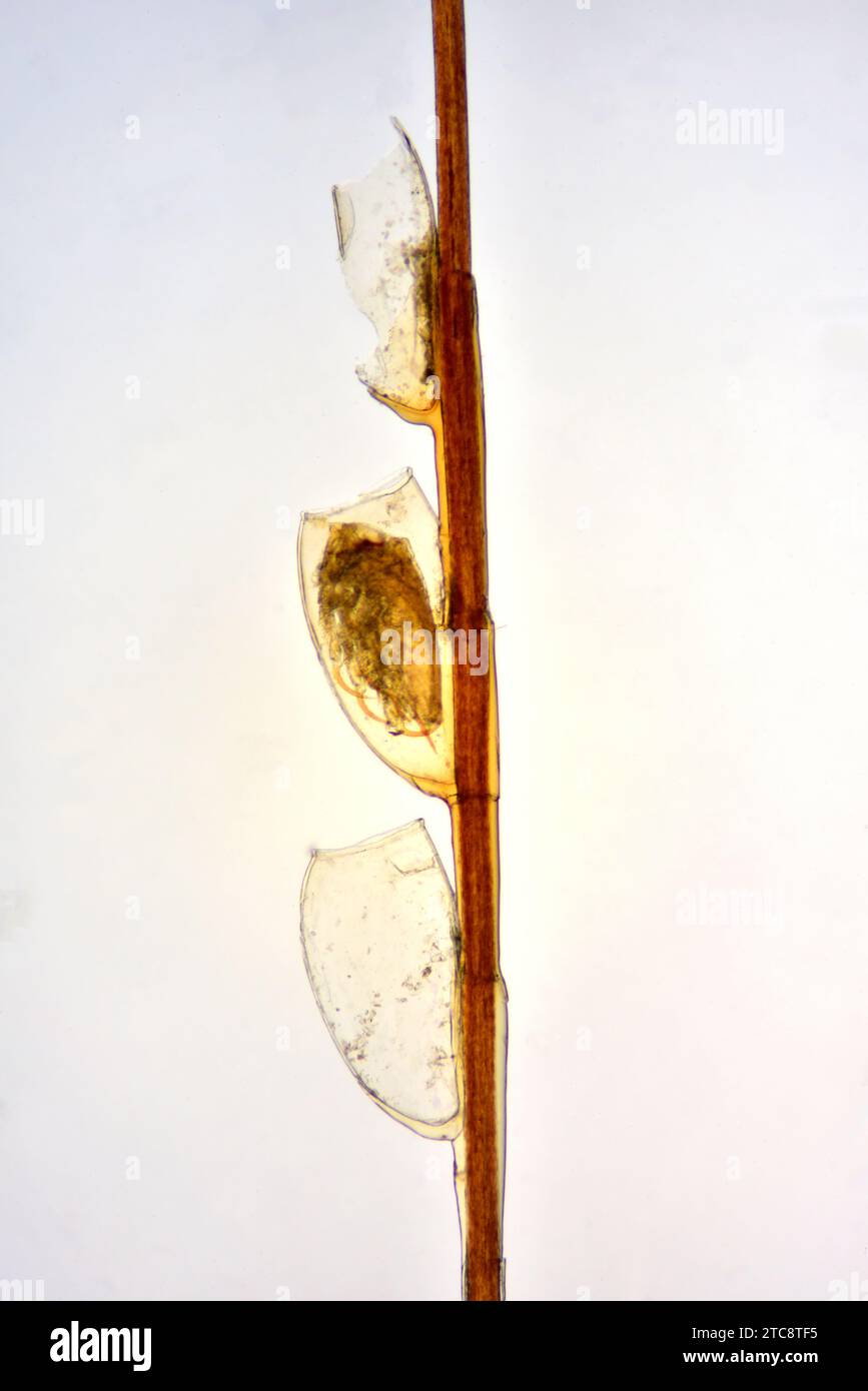 Kopflaus (Pediculus humanus capitis)-Larve an einem Haar (Nits). Lichtmikroskop X50 mit 10 cm Breite. Stockfoto