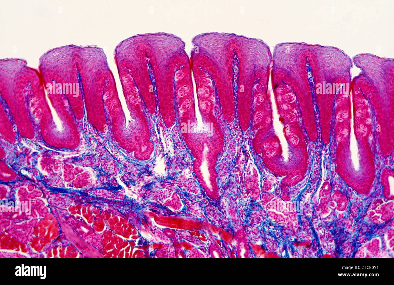 Gustatorische Papillen auf der menschlichen Zunge mit Geschmacksknospen im Epithel. Lichtmikroskop X25 mit 36 mm Breite. Querschnitt. Stockfoto Gustatorische Papillen auf der menschlichen Zunge mit Geschmacksknospen im Epithel. Lichtmikroskop X25 mit 36 mm Breite. Querschnitt. Stockfoto