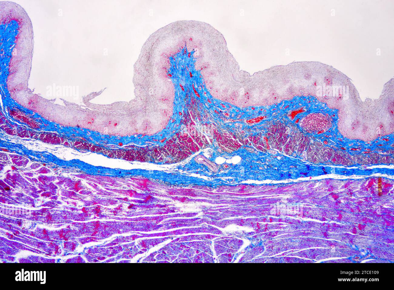 Menschliche Speiseröhre oder Speiseröhre mit Plattenepithel geschichtet. Optisches Mikroskop X40. Stockfoto