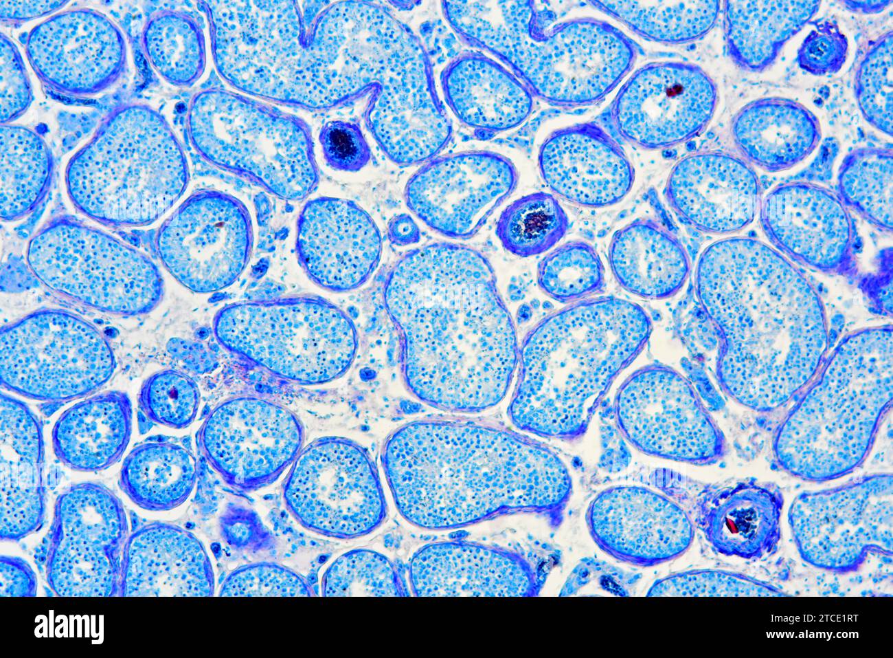 Humaner Hoden oder Hodenabschnitt mit seminiferösen Tubuli, Leydig-Zellen, Sertoli-Zellen, Spermatozyten und Spermatogonien. Optisches Mikroskop X100. Stockfoto