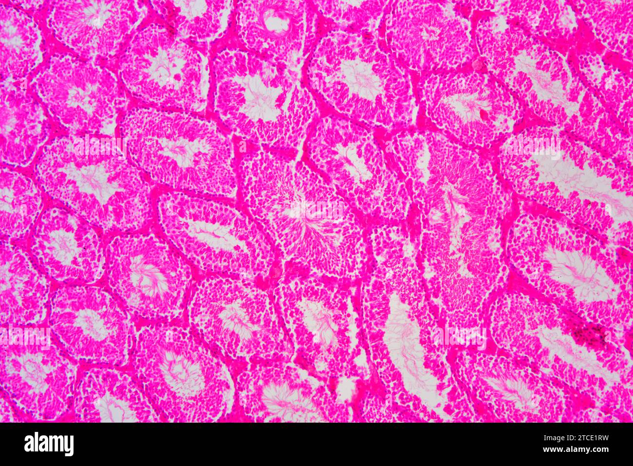 Humaner Hoden- oder Hodenabschnitt mit Tubulus seminiferus, Leydig-Zellen, Sertoli-Zellen, Spermatozyten, Spermatogonien, Spermatide und Spermatozoon Stockfoto