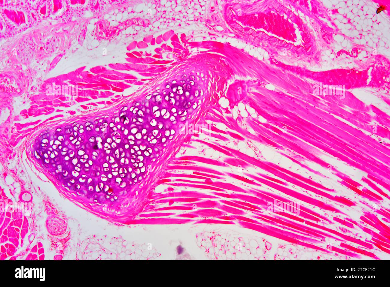 Trachea- oder Luftröhrenquerschnitt. Optisches Mikroskop X100. Stockfoto