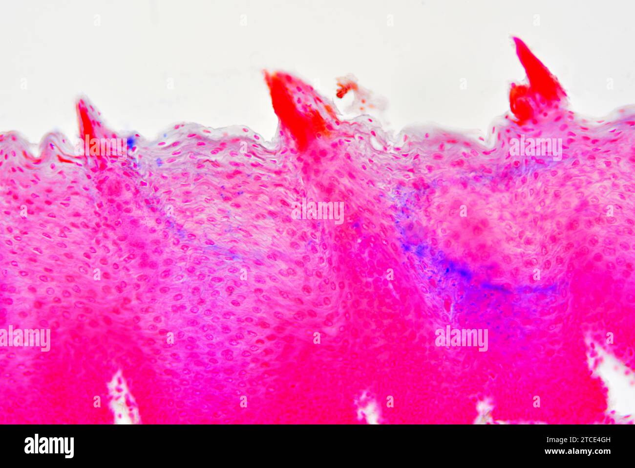 Zungenabschnitt mit lingualen Papillen. Optisches Mikroskop X200. Stockfoto