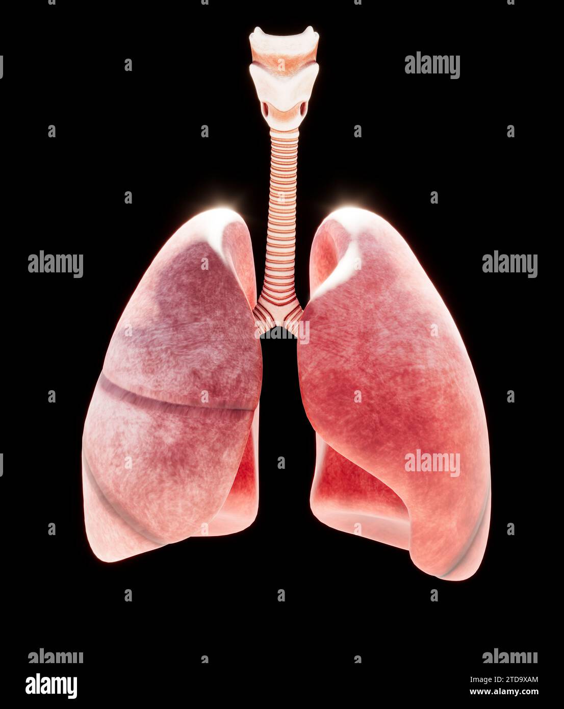 Luftröhre und Bronchialbaum, Entzündung, die Bronchitis verursacht. Akute oder chronische Entzündung. Virale Bronchitis wird durch ein Virus verursacht und ist ansteckend Stockfoto