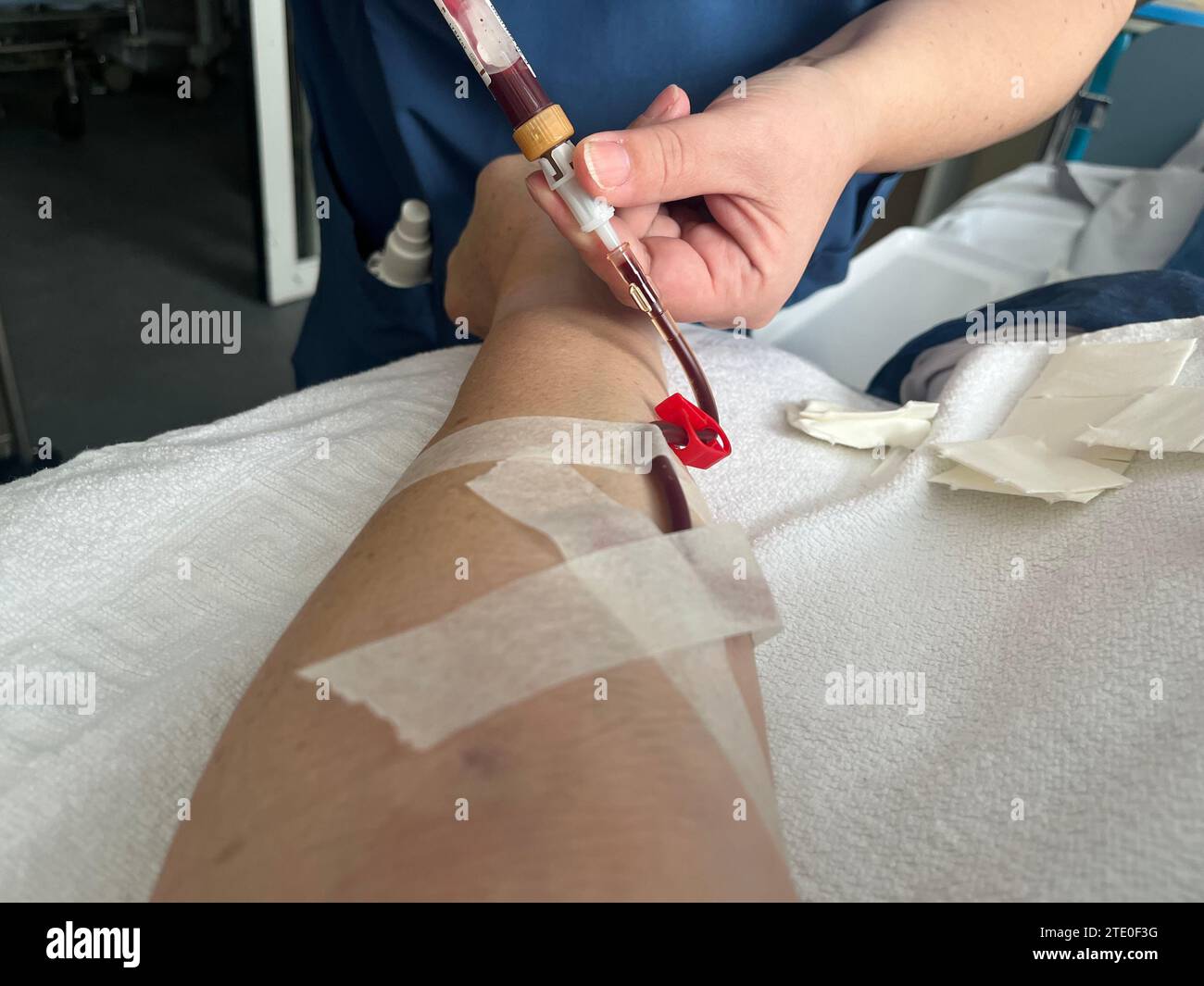 Eine Krankenschwester zieht Blut aus einer Vene im Unterarm eines Mannes. Stockfoto