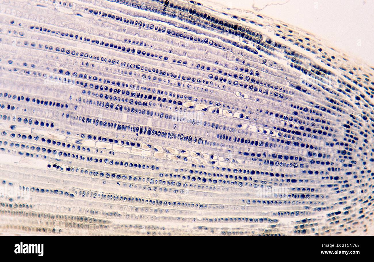 Apikaler Wurzelmeristem mit Zellteilung (Mitose) und Raphiden. Photomikrographische Zwiebelwurzel. Stockfoto