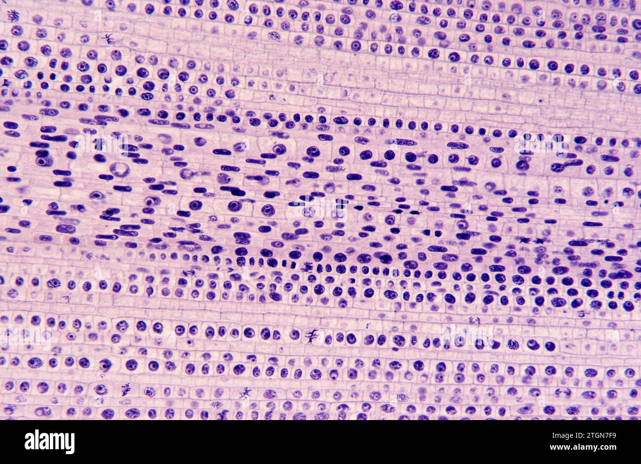Apikaler Wurzelmeristem mit Zellteilung (Mitose). Photomikrographische Zwiebelwurzel. Stockfoto