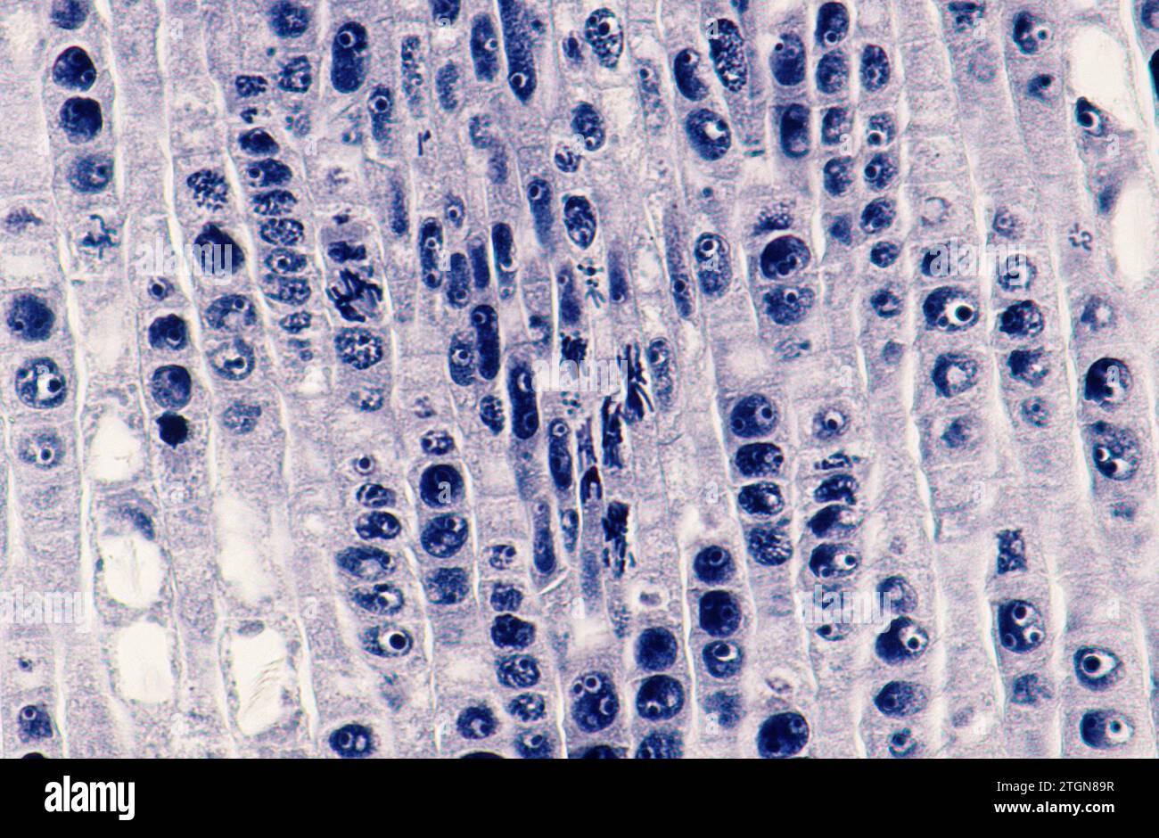 Apikaler Wurzelmeristem mit Zellteilung (Mitose). Photomikrographische Zwiebelwurzel. Stockfoto