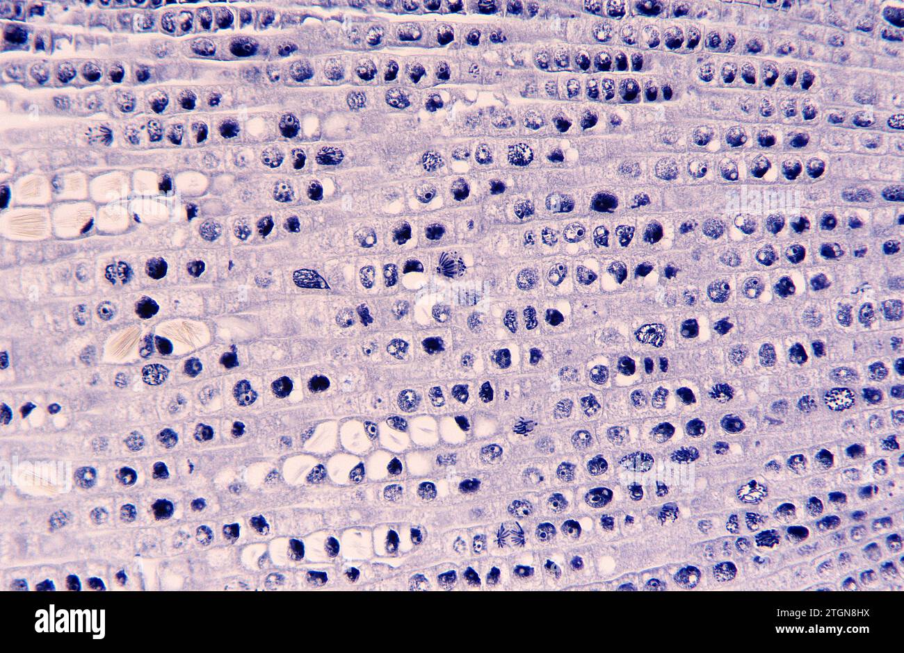 Apikaler Wurzelmeristem mit Zellteilung (Mitose) und Raphiden. Photomikrographische Zwiebelwurzel. Stockfoto