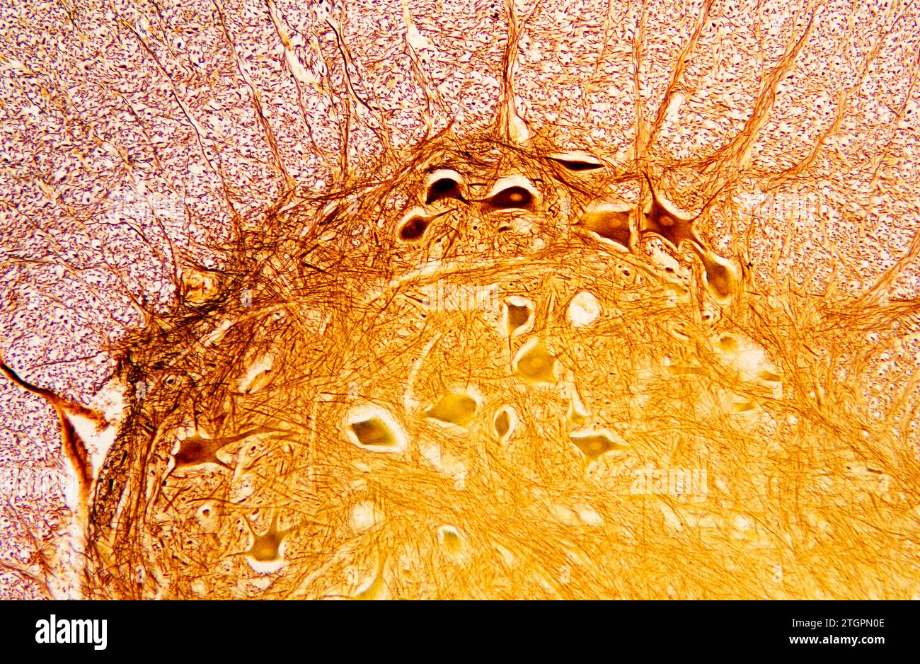 Rückenmark mit multipolaren motorischen Neuronen und grauer und weißer Substanz. Photomikrograph, Cajal-Färbung. Stockfoto
