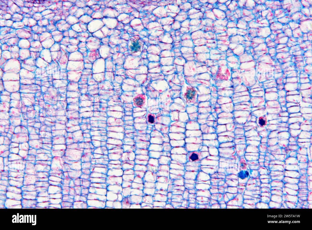 Raphide von Calciumoxalat in einer Pflanze Zelleln. Photomikrograph X100 mit einer Breite von 10 cm. Stockfoto