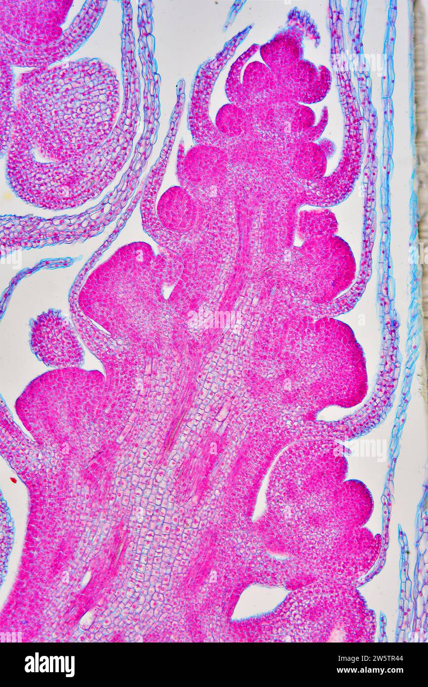 Apikaler Meristel des Spargels officinalis. Photomikrograph X50 bei 10 cm Höhe. Stockfoto