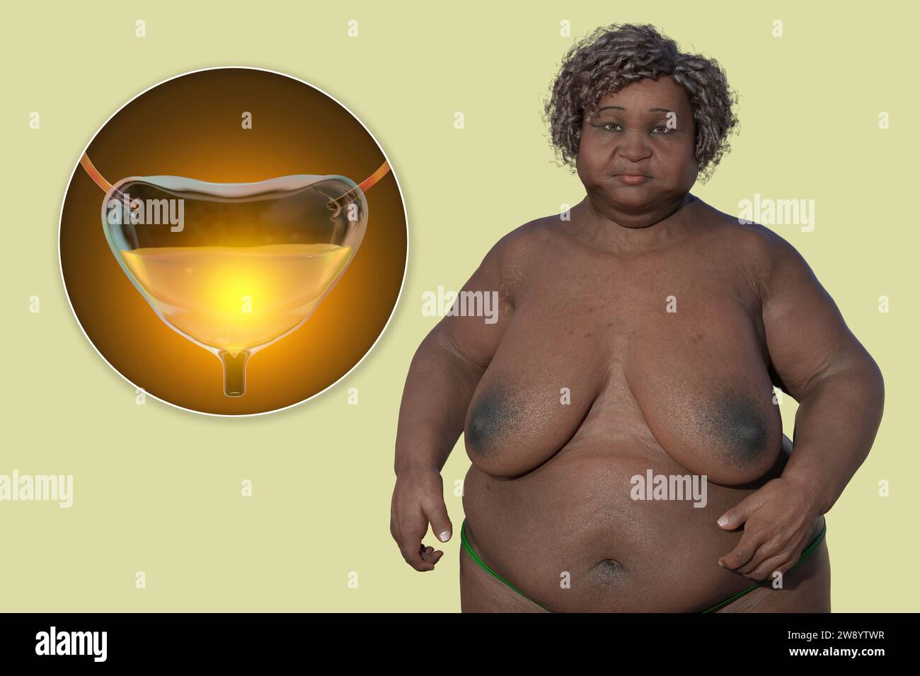 Ältere übergewichtige Frau und Harnblase, Illustration Stockfoto