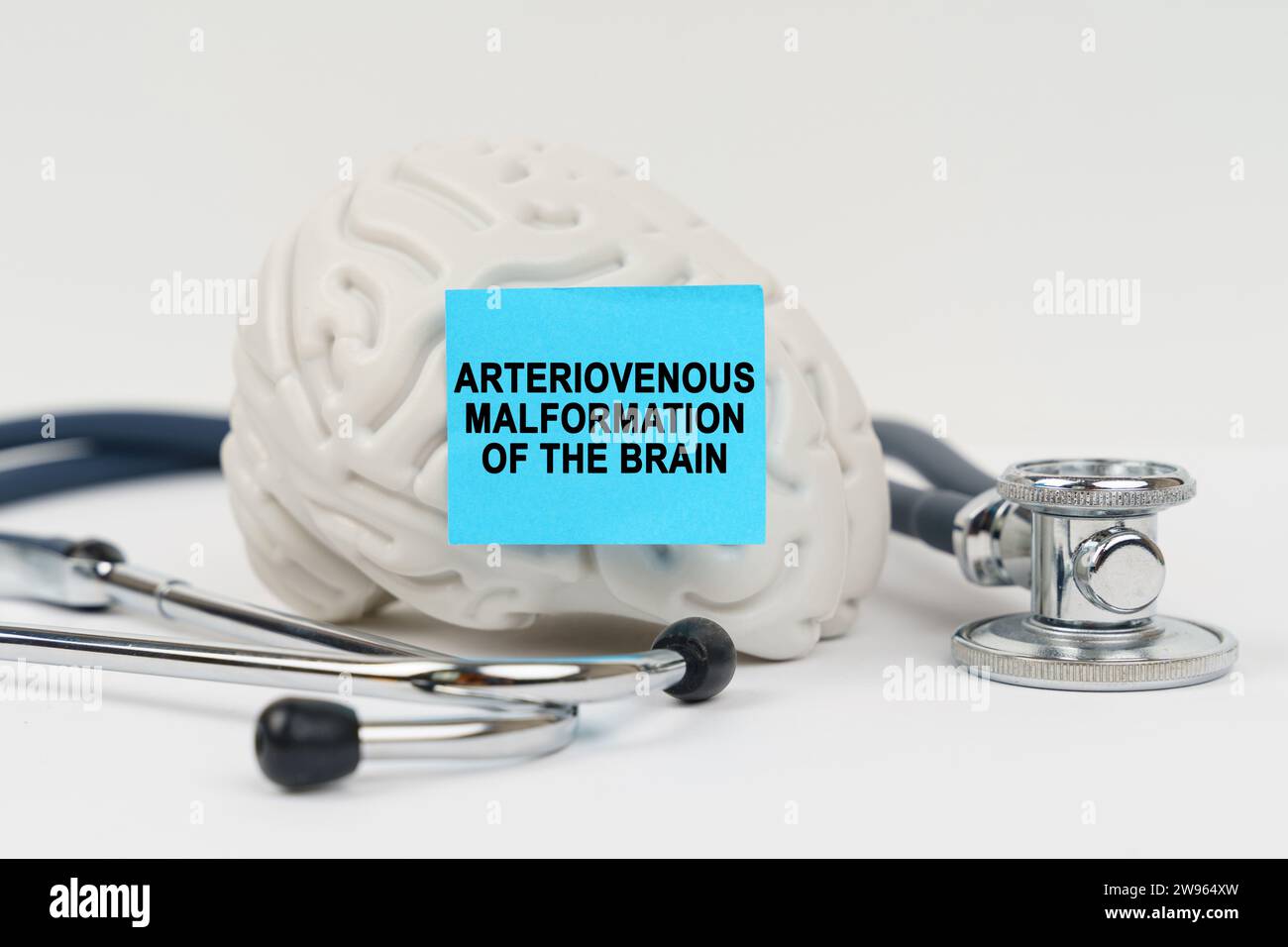 Medizinisches Konzept. Auf einer weißen Oberfläche neben dem Stethoskop befindet sich ein Gehirn, auf dem ein Aufkleber mit der Inschrift - arteriovenöse Missbildung des b steht Stockfoto