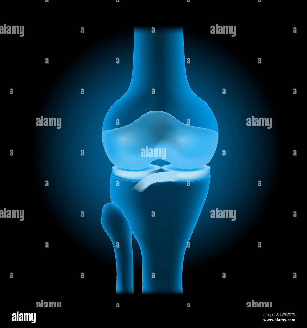Die Anatomie des Kniegelenks. Vorderansicht des menschlichen Kniegelenkes mit leuchtender Wirkung. Realistisches transparentes blaues Gelenk mit Knochen, Meniskus, Bändern und Knorpel am da Stock Vektor