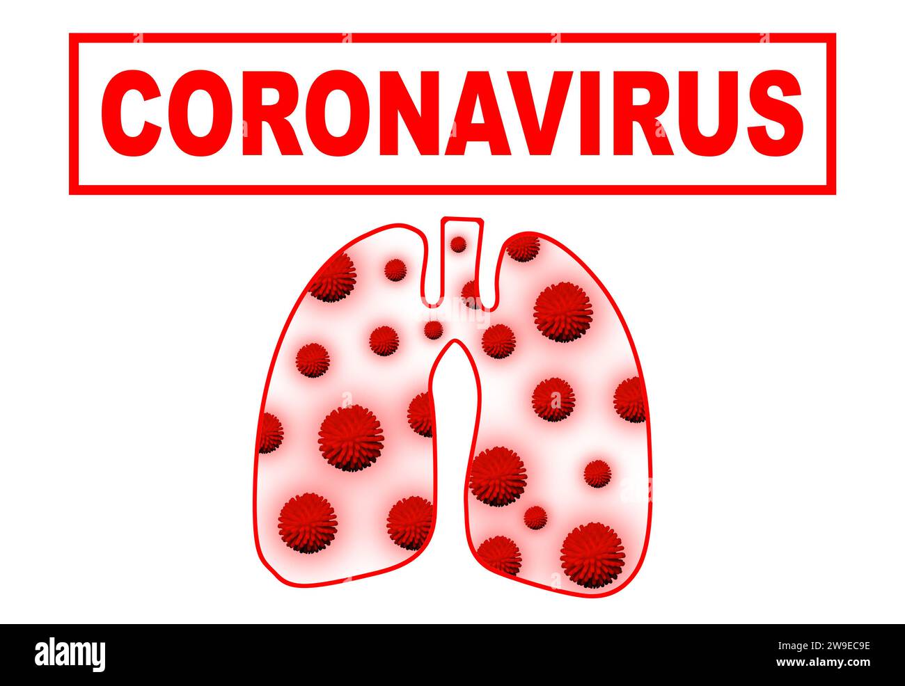 Lungen mit COVID-19-Virus. Coronavirus infiziert die Lunge mit beidseitiger Pneumonie. Coronavirus-Pandemiekonzept. Stockfoto