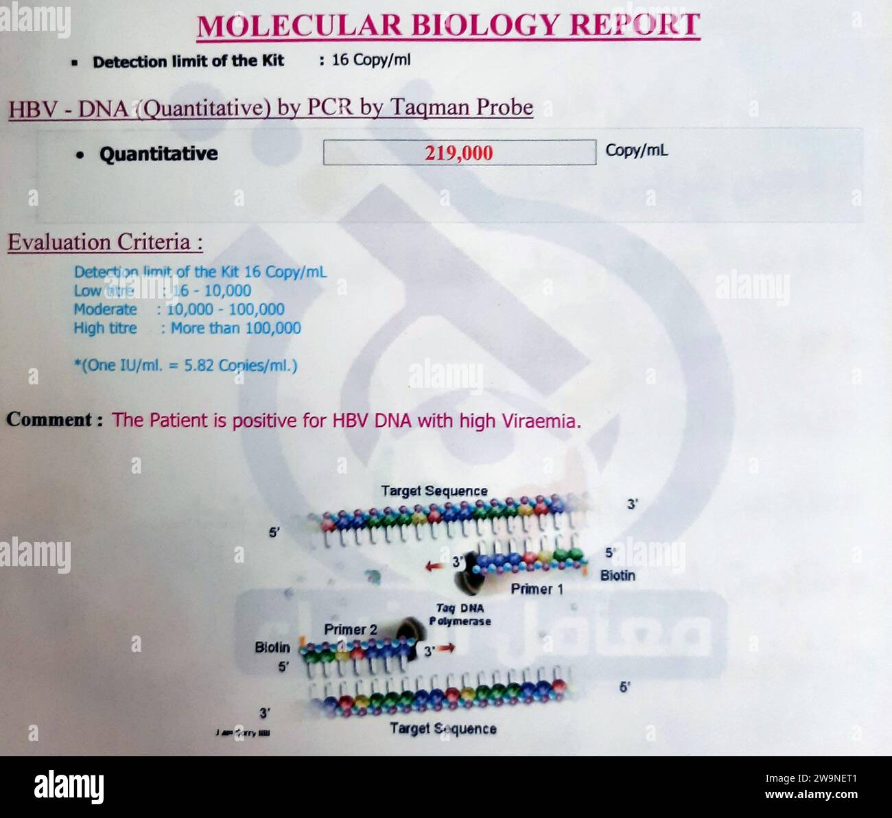 Kairo, Ägypten, 7. November 2023: Hepatitis-B-Virus-DNA-Labortest mit hoher Virämie 219000 Kopien pro ml, HBV-DNA-PCR-positiver Test durch Taqman-Sonde in einem Mo Stockfoto