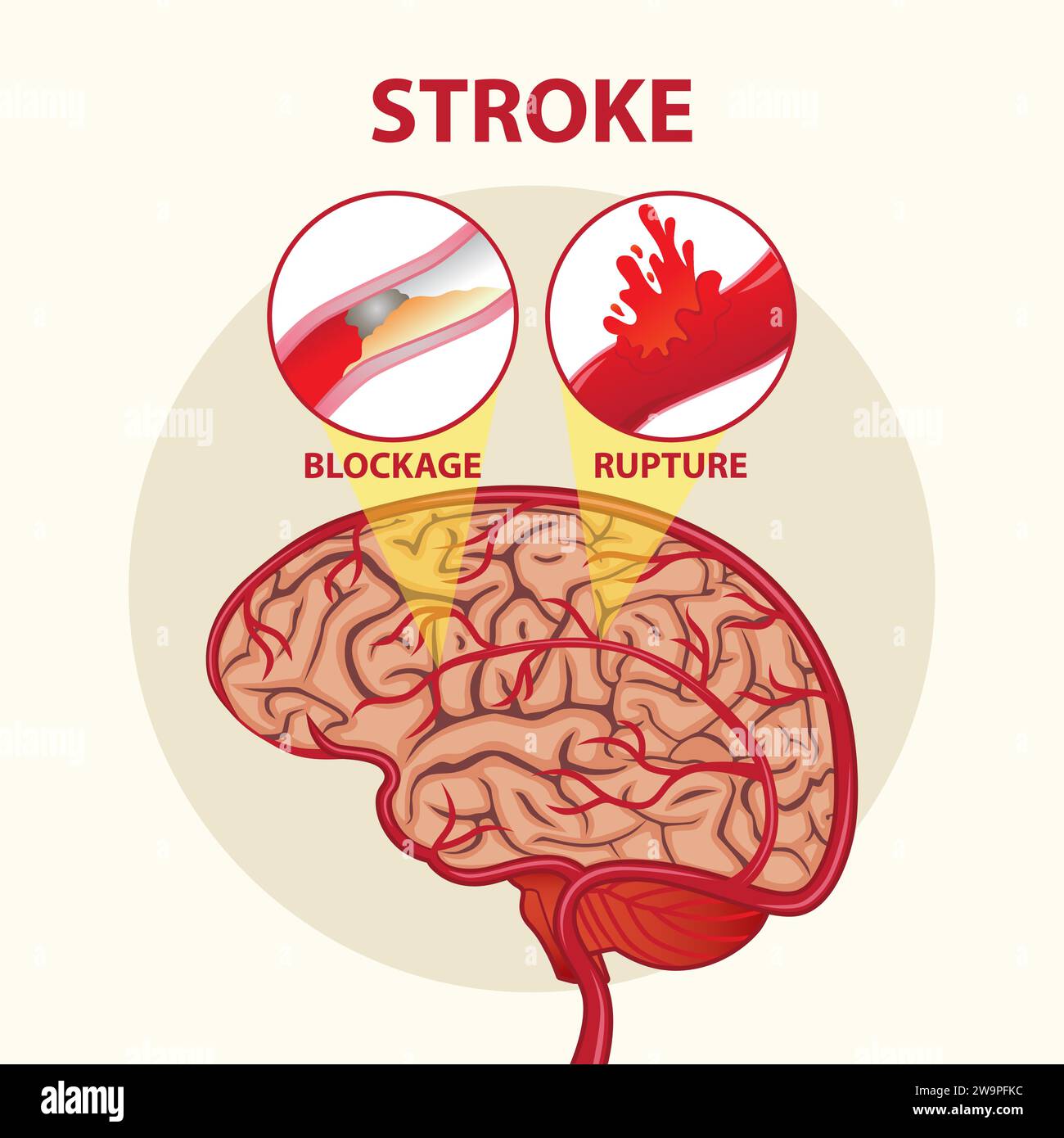 Stroke Day Brain Illustrations Design Stock Vektor