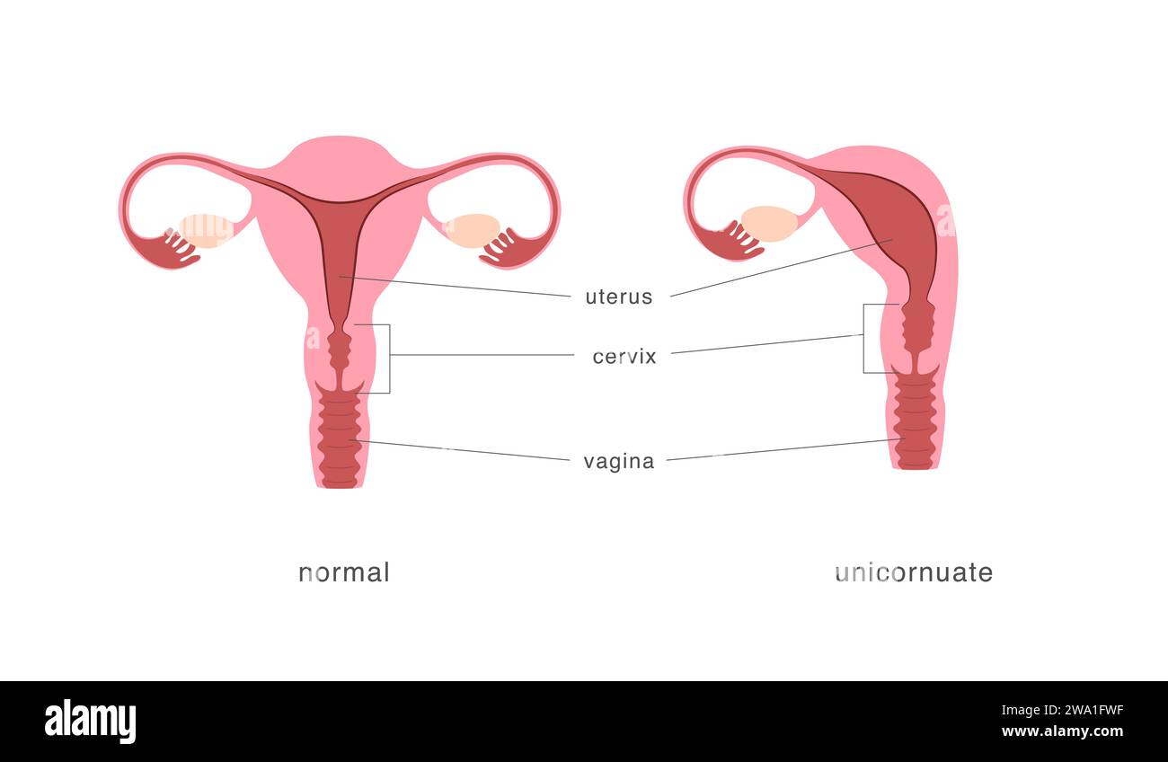 Anatomie missbildung Ausgeschnittene Stockfotos und bilder Alamy