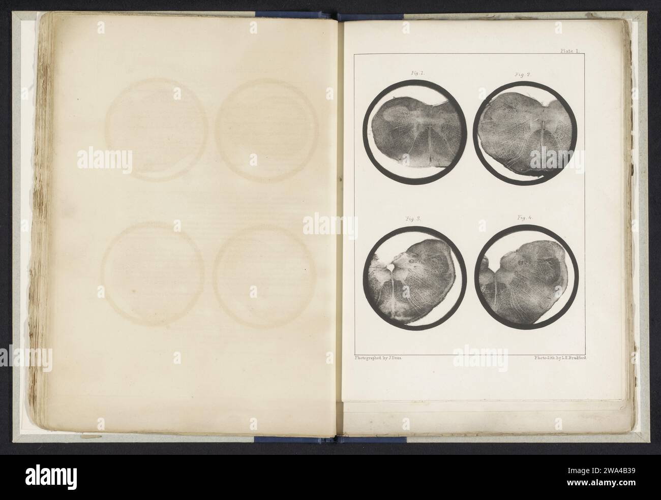 Vier Details einer Medulla oblongata von einem Schaf, John Dean, um 1854 - in oder vor 1864 photomechanischen Druckpapierfotolithographien Gehirnen Stockfoto