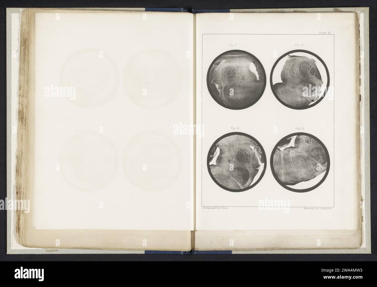 Vier Details einer Medulla oblongata von einem Schaf, John Dean, um 1854 - in oder vor 1864 photomechanischen Druckpapierfotolithographien Gehirnen Stockfoto