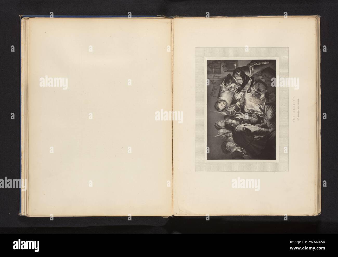 Reproduktion eines Druckes des Zahnziehens am Zahnarzt von D.J. Pound an Gerard van Honthorst, Anonym, nach Daniel John Pound, nach Gerard van Honthorst, um 1870 - in oder vor 1875 photomechanischen Druckpapier (Barber as) Zahnarzt Stockfoto