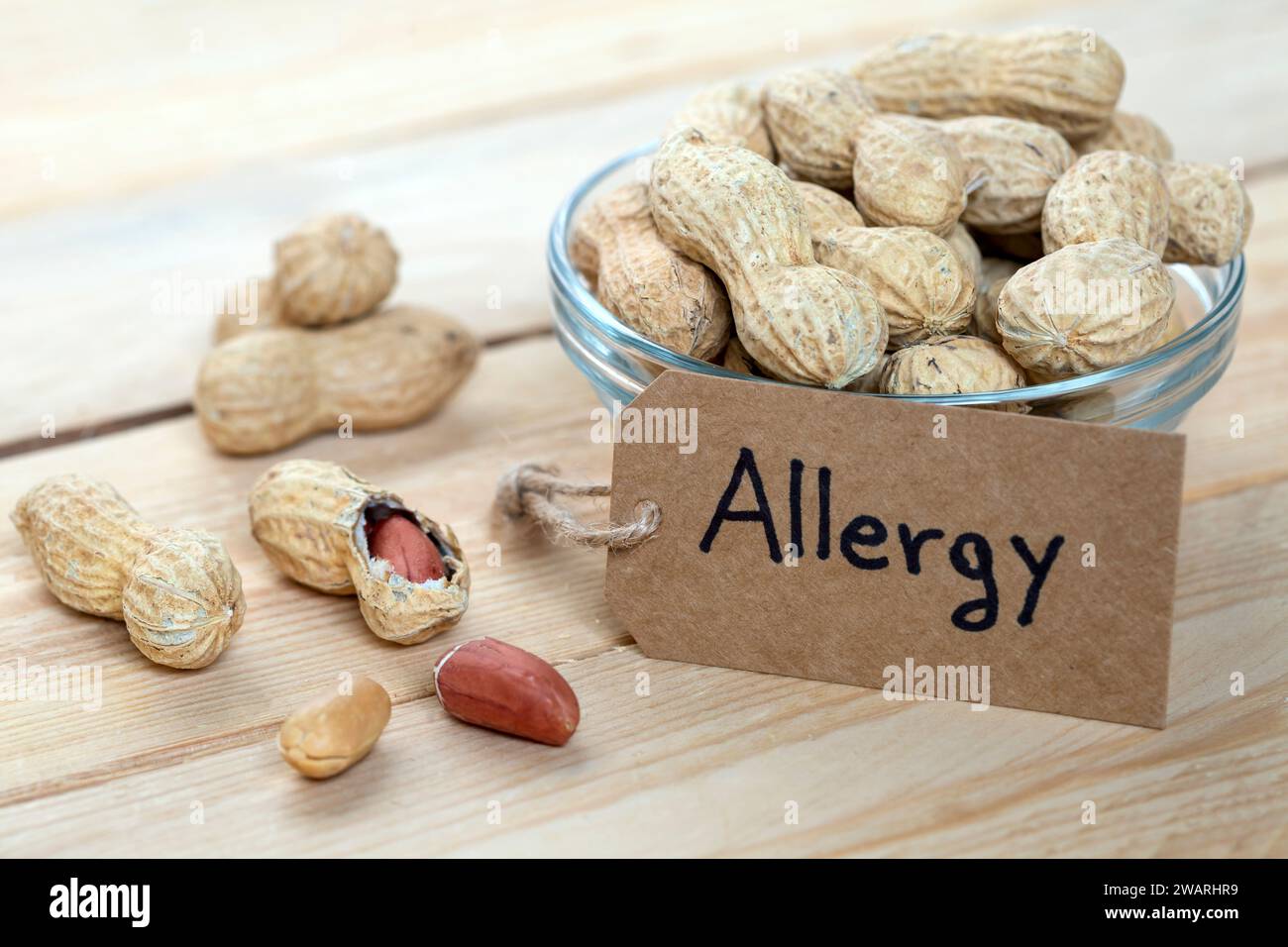 Schüssel mit Erdnüssen mit Etikett „Allergie“ Stockfoto