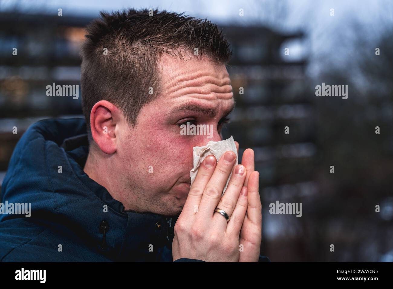 Bayern, Deutschland - 6. Januar 2024: Ein kranker Mann mit Erkältung bläst sich mit einem Papiertaschentuch die Nase *** ein kranker erkälteter Mann putzt sich mit einem Papiertaschentuch die Nase Stockfoto