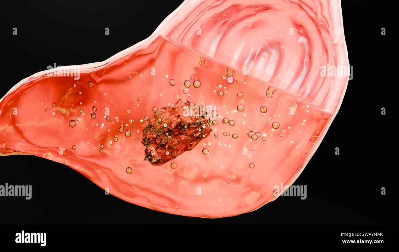 Menschlicher Magen Anatomie Verdauung, Ösophagus Abdomen Magen mit saurem Verdauungstrakt, Querschnitt isoliert vom inneren Organ, Magen Darm, Prozess von Stockfoto