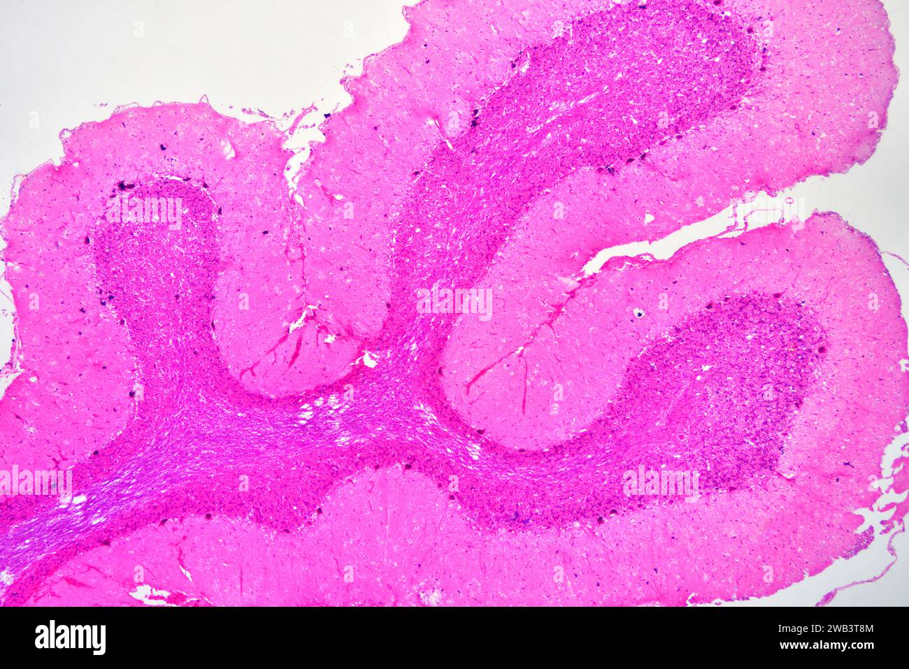 Juman Rind Cerebelo humano histología -Fotos und -Bildmaterial in hoher Auflösung ...