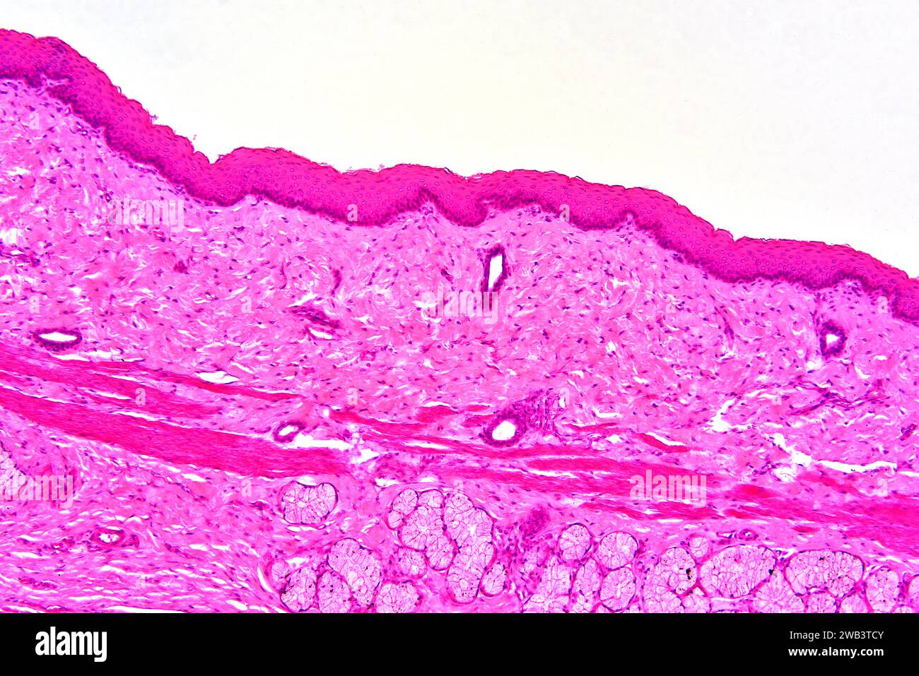 Humanes geschichteten Plattenepithel, glatte Muskulatur und sekretorische Drüse. X 75 bei 10 cm Breite. Stockfoto