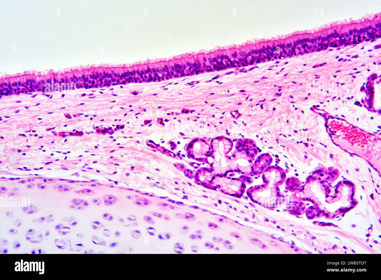 Humanes ciliiertes pseudostratifiziertes Säulenepithel. Trachea X125 mit einer Breite von 10 cm. Unten links Knorpel mit Chondrozyten. Stockfoto