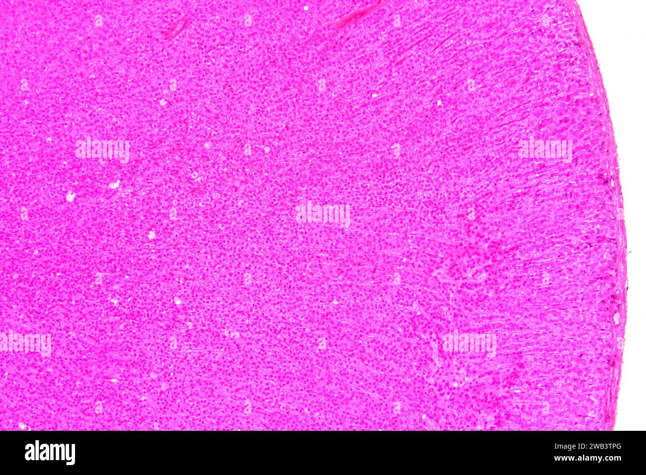 Die menschliche Nebenniere oder Nebenniere ist eine endokrine Drüse, die Hormone wie Adrenalin, Noradrenalin, Aldosteron oder Cortisol absondert. X75 bei 10 Stockfoto
