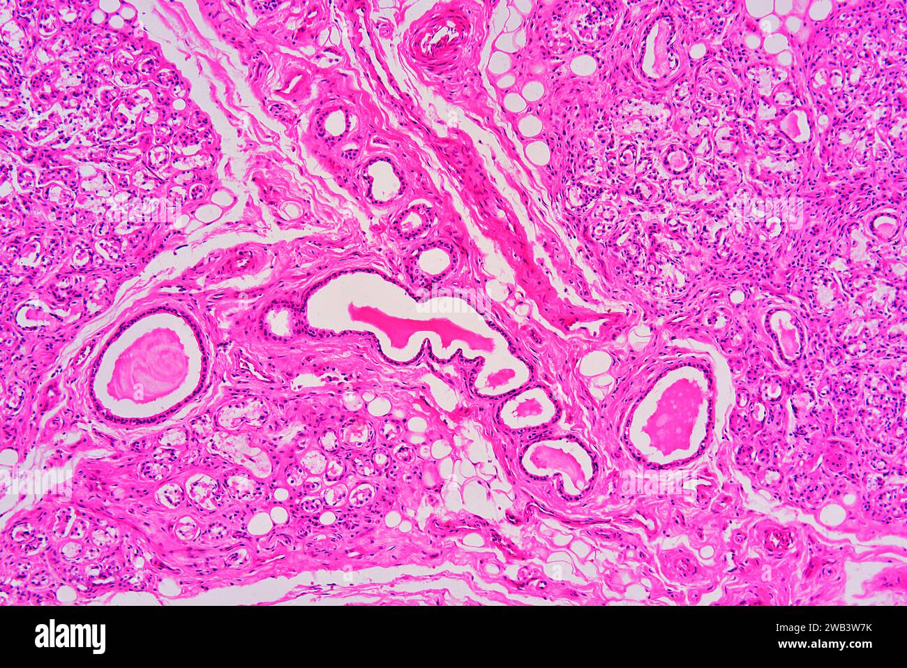 Humane Nabelschnur-Schleimhäute mit Schleimdrüsen, lockeres konjektives Gewebe, Adipozyten, glatten Muskelfasern und Blutgefäßen. X125 bei 10 cm Breite. Stockfoto