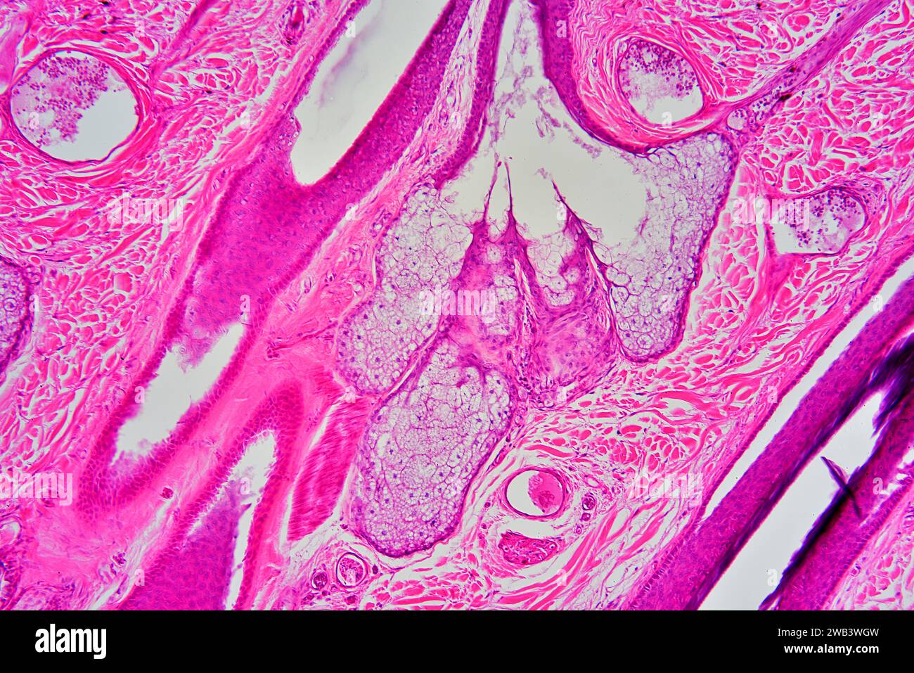 Menschliche Haut mit Talgdrüse, Blutgefäßen und Haarfollikel. X 75 bei 10 cm Breite. Stockfoto