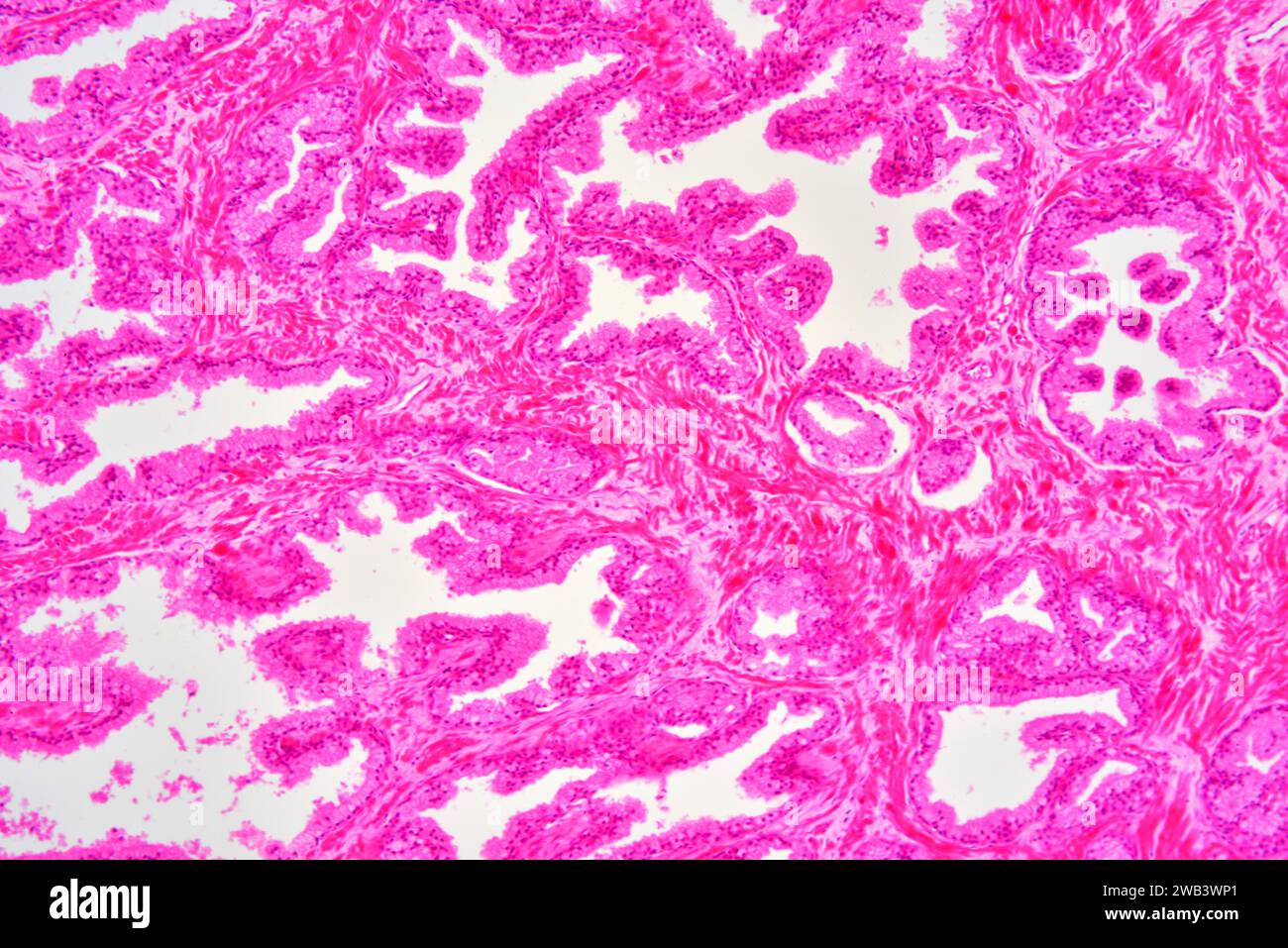 Humane Prostata mit Bindegewebe, Lumen von Drüsen und Epithelzellen. X 75 bei 10 cm Breite. Stockfoto