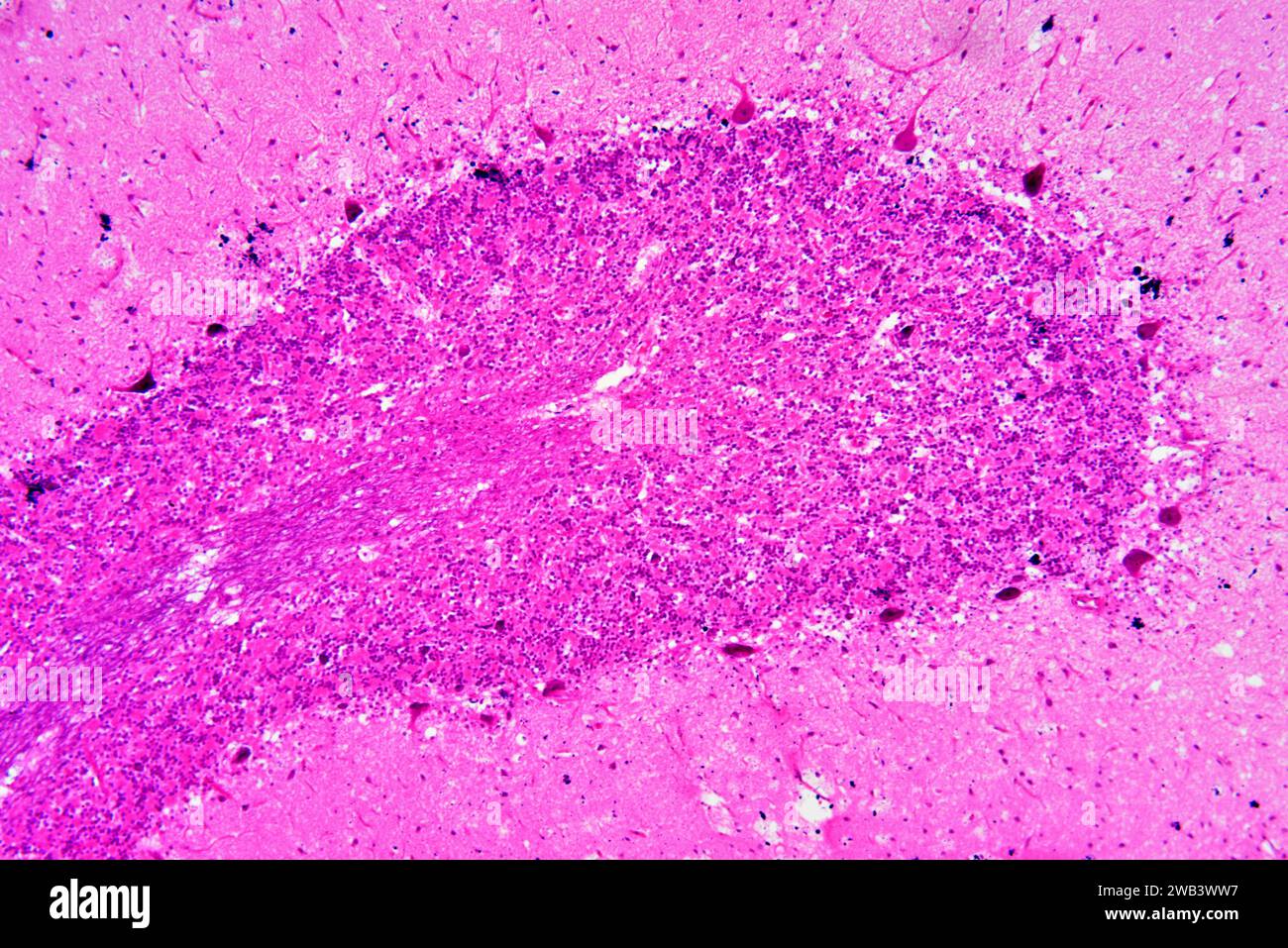 Menschliches Nervensystem, Kleinhirn-motorischer Cortex mit Purkinje-Zellen. X 75 bei 10 cm Breite. Stockfoto